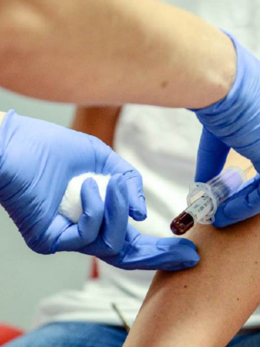 Пет навики кои помагаат во намалување на лошиот холестерол